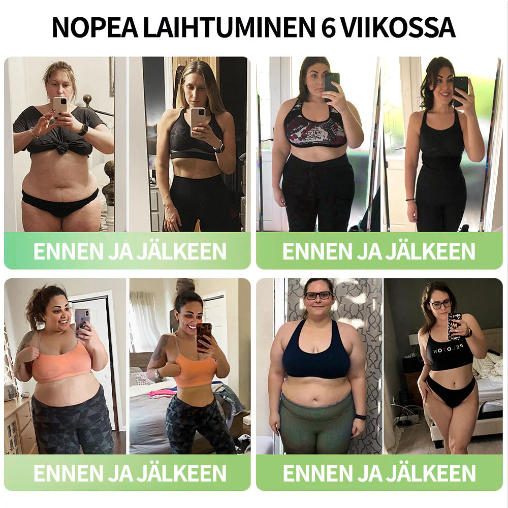 Croaie® GLP-1 Laihdutus- ja Terveysvahvistustipat 🏆🏆 (Elintarvikelaatuinen rasvanpolttaja – Kehitetty The Obesity Society -järjestön toimesta)