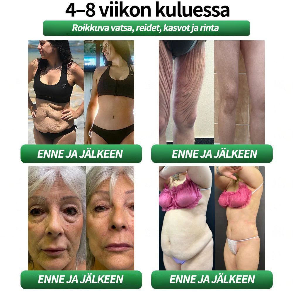Virallinen kauppa | CROAIE® GLP-1 & Matrixyl 3000 Laihdutus- & Terveystipat (Vain yksi annos päivässä — näkyviä tuloksia vain 7 päivässä)Sopii lihavuuteen, sydän- ja verenkiertoelimistön terveyteen, diabetekseen, uniapneaan, nivelongelmiin ja muuhun 🎉