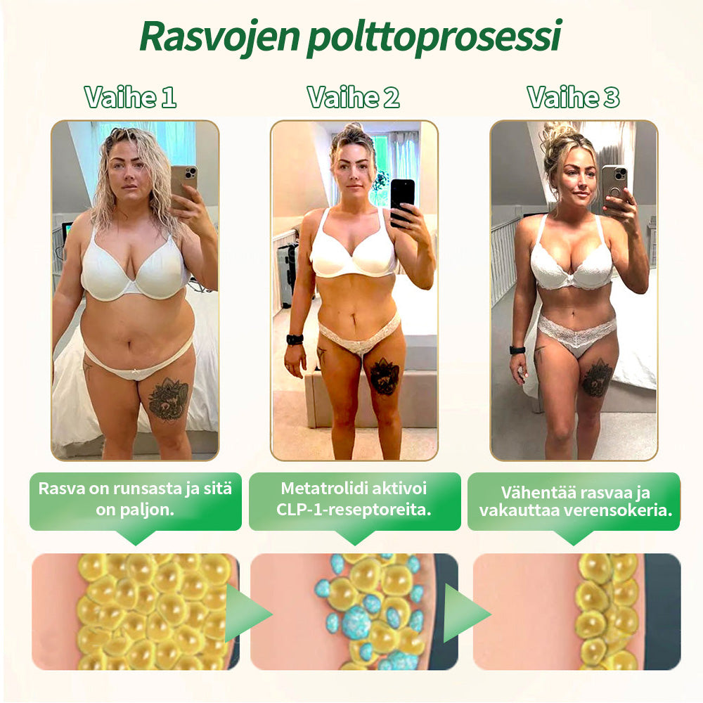 Virallinen kauppa | CROAIE® GLP-1 & Matrixyl 3000 Laihdutus- & Terveystipat (Vain yksi annos päivässä — näkyviä tuloksia vain 7 päivässä)Sopii lihavuuteen, sydän- ja verenkiertoelimistön terveyteen, diabetekseen, uniapneaan, nivelongelmiin ja muuhun 🎉