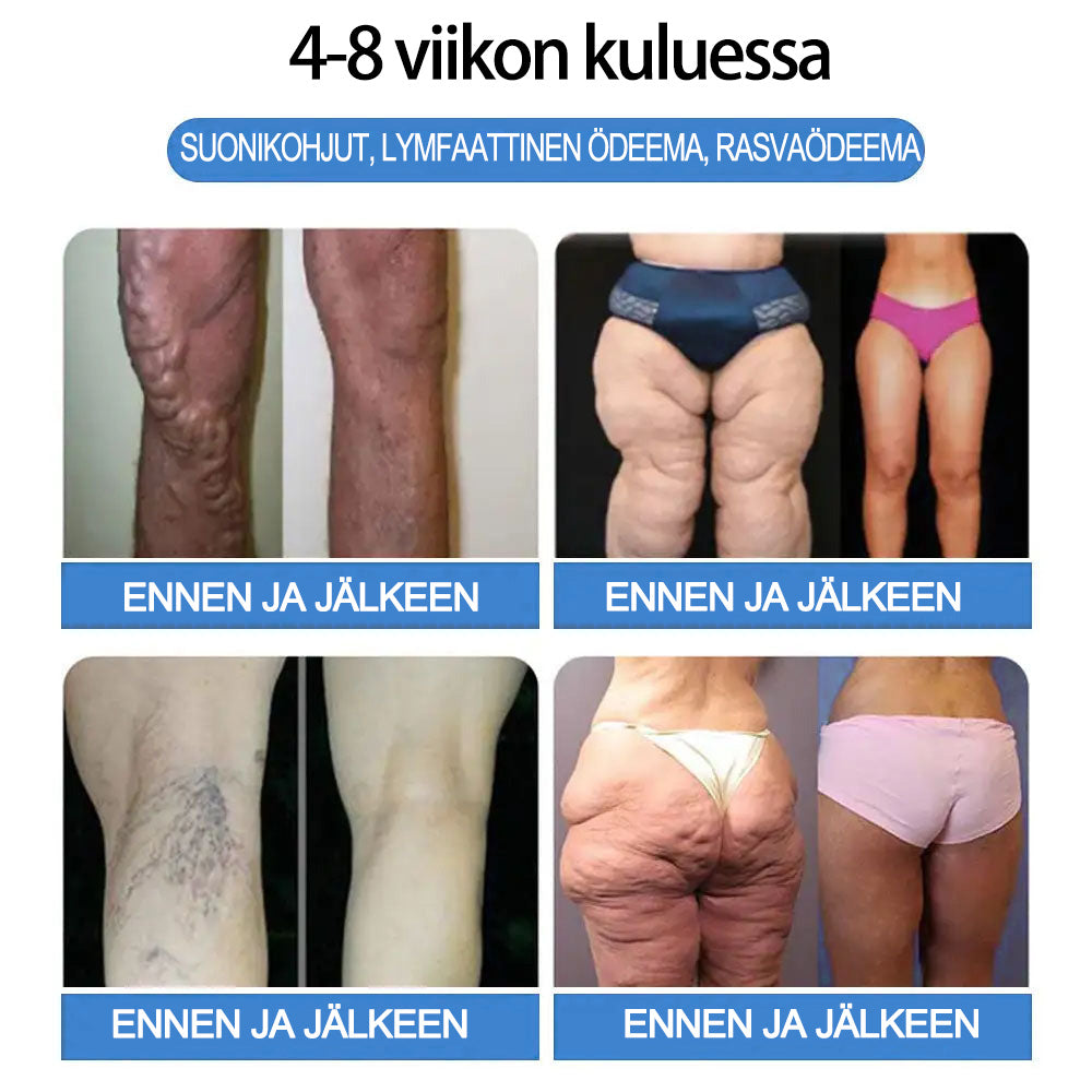 Mayo Clinicin suosittelema | Virallinen verkkokauppa | CROAIE® GLP-1 Painonpudotukseen tarkoitettu oraaliliuos 👨⚕️Liikalihavuus, sydän- ja verisuonitaudit, diabetes, uniapnea, nivelongelmat ja paljon muuta