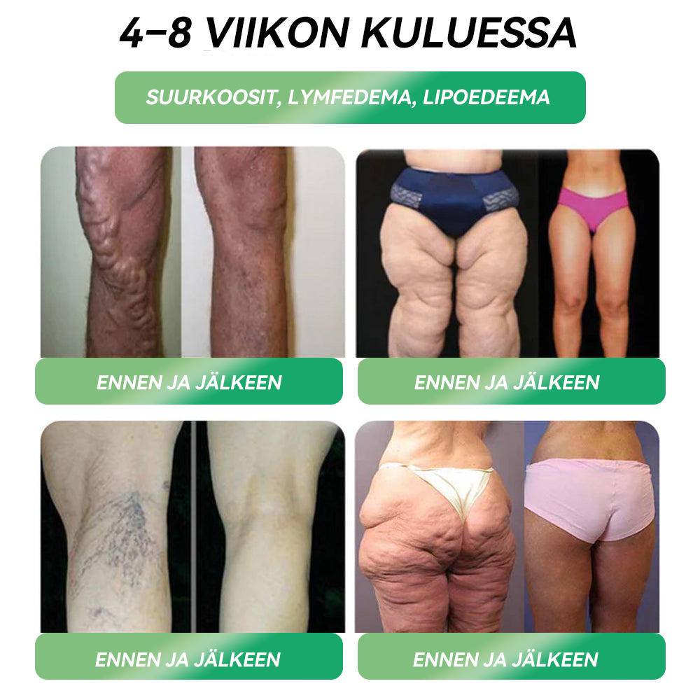 Virallinen Kauppa | HONXI®🍒𝐺𝐿𝑃-𝟏 6-in-1 Terveysratkaisu Suun kautta otettava neste (Vain yksi annos päivässä — näkyviä tuloksia jo 7 päivässä) ✅ Lihavuuteen, sydän- ja verisuoniterveyteen, diabetekseen, uniapneaan, nivelongelmiin ja muuhun