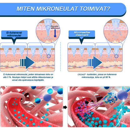 [7 Päivää, tulokset näkyvissä] 🇫🇮 CROAIE® SMGT-GLP-1 Nano-neulaplästeri (Kivuton, pitkäkestoinen, diabetekseen, liikalihavuuteen ja sydän- ja verisuonitauteihin)💥