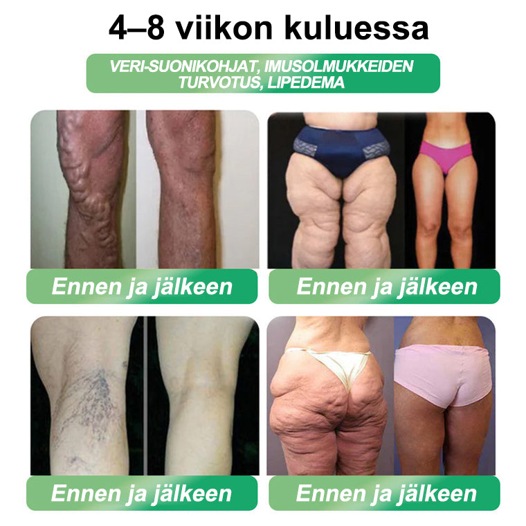 𝐎𝐟𝐟𝐢𝐜𝐢𝐚𝐥 𝐒𝐭𝐨𝐫𝐞 🇫🇮 𝐂𝐑𝐎𝐀𝐈𝐄® 𝐆𝐋𝐏-𝟏 𝐖𝐞𝐢𝐠𝐡𝐭 𝐋𝐨𝐬𝐬 𝐎𝐫𝐚𝐥 𝐒𝐨𝐥𝐮𝐭𝐢𝐨𝐧 – 𝐎𝐛𝐞𝐬𝐢𝐭𝐲, 𝐂𝐚𝐫𝐝𝐢𝐨𝐯𝐚𝐬𝐜𝐮𝐥𝐚𝐫 𝐃𝐢𝐬𝐞𝐚𝐬𝐞, 𝐃𝐢𝐚𝐛𝐞𝐭𝐞𝐬, 𝐒𝐥𝐞𝐞𝐩 𝐀𝐩𝐧𝐞𝐚, 𝐉𝐨𝐢𝐧𝐭 𝐏𝐫𝐨𝐛𝐥𝐞𝐦𝐬 𝐚𝐧𝐝 𝐌𝐨𝐫𝐞 🔥