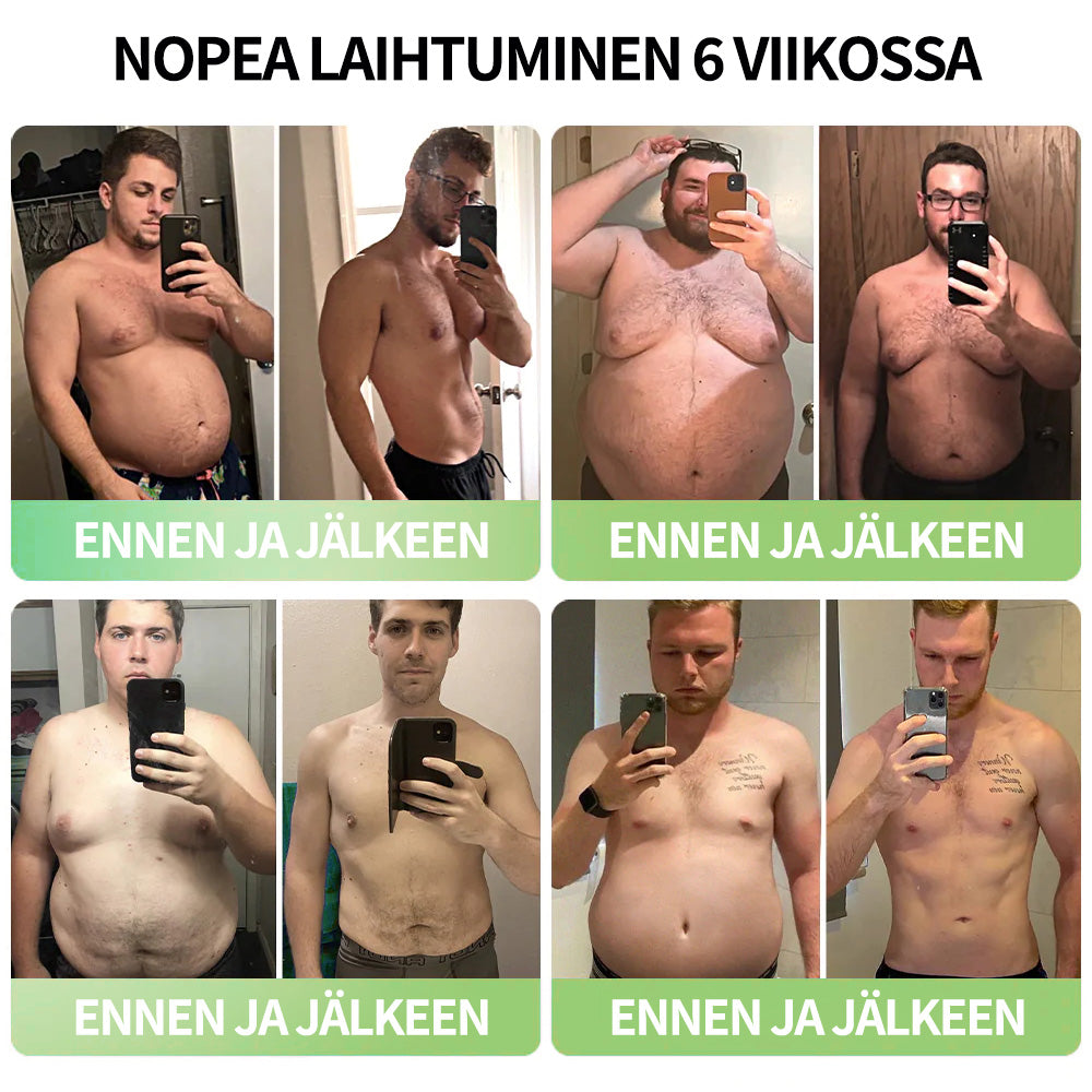 Croaie® GLP-1 Laihdutus- ja Terveysvahvistustipat 🏆🏆 (Elintarvikelaatuinen rasvanpolttaja – Kehitetty The Obesity Society -järjestön toimesta)
