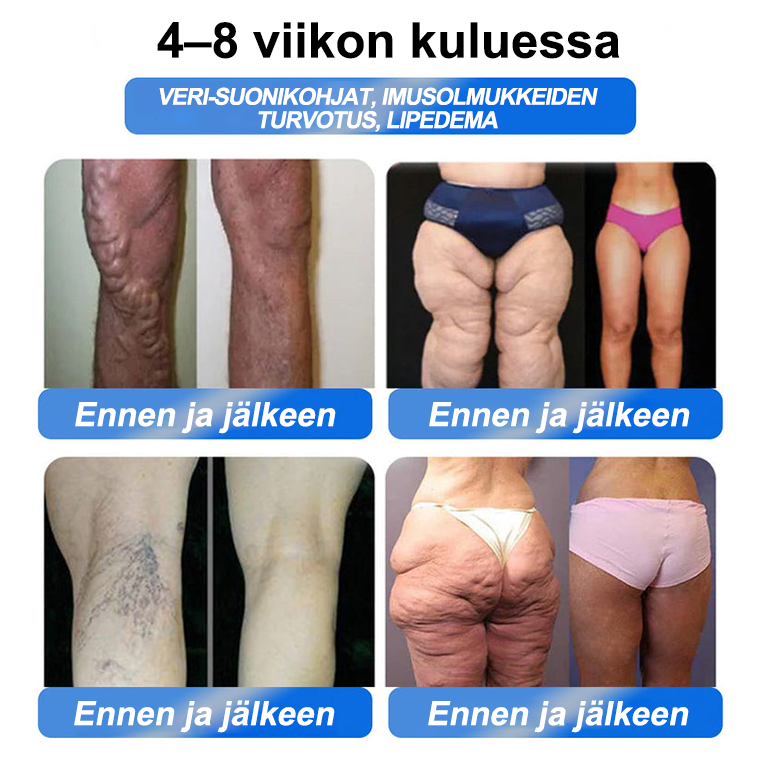 [Virallinen Kauppa] CroAie® GLP-1 & NAD+ Laihdutustipat ✅  Liikalihavuus, Sydän- ja verisuonitaudit, Diabetes, Uniapnea, Nivelongelmat ja paljon muuta