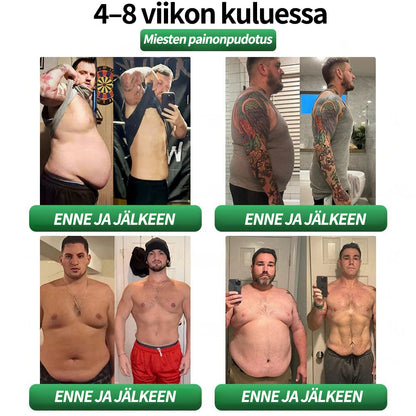Virallinen kauppa | CROAIE® GLP-1 & Matrixyl 3000 Laihdutus- & Terveystipat (Vain yksi annos päivässä — näkyviä tuloksia vain 7 päivässä)Sopii lihavuuteen, sydän- ja verenkiertoelimistön terveyteen, diabetekseen, uniapneaan, nivelongelmiin ja muuhun 🎉