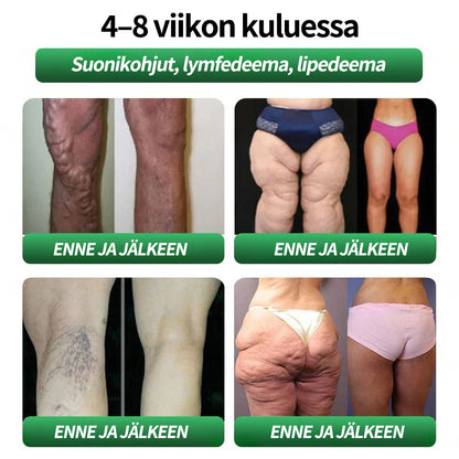 Virallinen kauppa | CROAIE® GLP-1 & Matrixyl 3000 Laihdutus- & Terveystipat (Vain yksi annos päivässä — näkyviä tuloksia vain 7 päivässä)Sopii lihavuuteen, sydän- ja verenkiertoelimistön terveyteen, diabetekseen, uniapneaan, nivelongelmiin ja muuhun 🎉