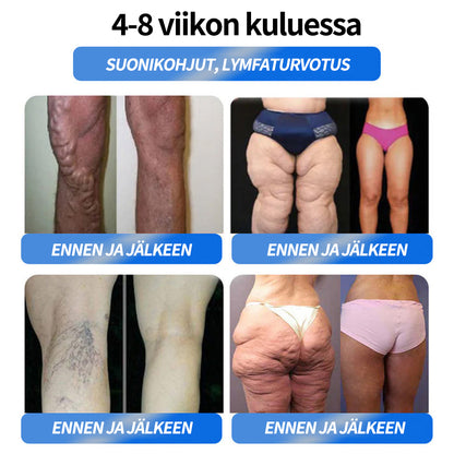 Honxi® ⚡GLP-1 Max Painonpudotus Suun kautta otettava liuos ✅ Yksi annos päivässä — näkyviä tuloksia jo 7 päivässä 👩‍⚕️ Soveltuu ylipainoon, sydän